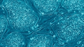 Human embryonic stem cells are examined under a microscope.