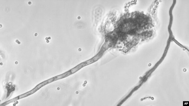 This photo made available by the Centers for Disease Control and Prevention shows a branch of the fungus Aspergillus fumigatus blamed for causing a meningitis outbreak.