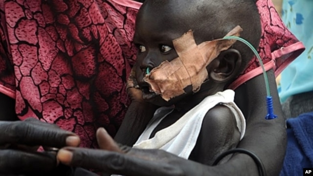 An infant with nasally inserted feeding tube at the nutrition center, Yida refugee camp, South Sudan, Dec. 12, 2011.