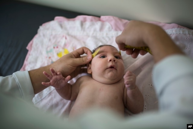 FILE – A neurologist measures the head of a baby suspected of having microcephaly, at Mestre Vitalino Hospital in Caruaru, Pernambuco state, Brazil. The condition may be linked to the mosquito-borne Zika virus.