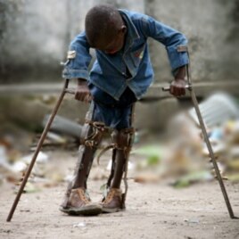 Bemorlar asosan Osiyo va Afrika mamlakatlarida