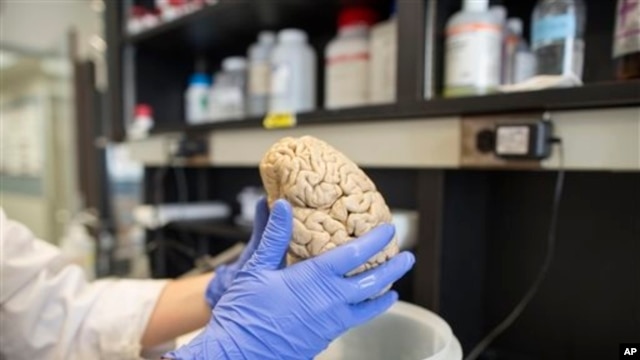 FILE- Researcher holds human brain in laboratory at Northwestern University's cognitive neurology and Alzheimer's disease center, Chicago, July 29, 2013.