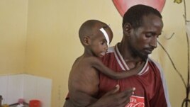 Abdulle Ibrahim, holds his son Adam Ibrahim at the International Rescue Committee, IRC, clinic in the town of Dadaab, Kenya, July 29, 2011.
