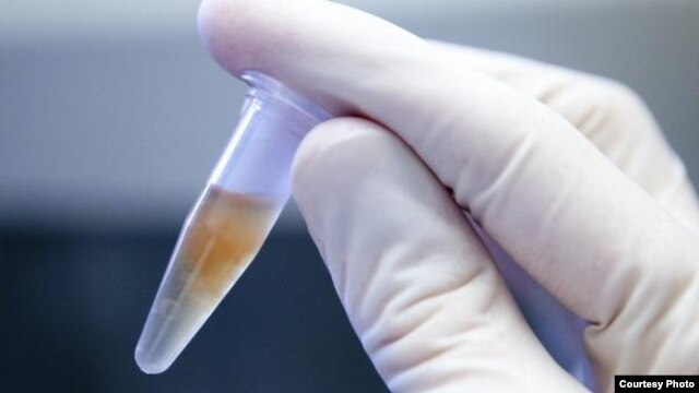 Silk protein in a vial. Silk worm cocoons are boiled as part of the process of extracting the protein. (Tufts University) 