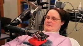 Mind-Controlled Artificial Hand