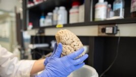 A researcher holds a human brain in a laboratory, (File photo).