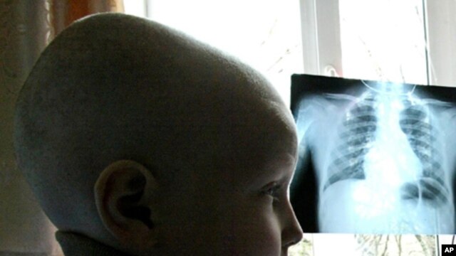 A young cancer patient in Donetsk, Ukraine. Radioactive fallout came down on the regions around the Chernobyl nuclear power plant after the explosion of its fourth reactor in 1986, leading to a rise of radiation-inflicted diseases in the population. (FILE