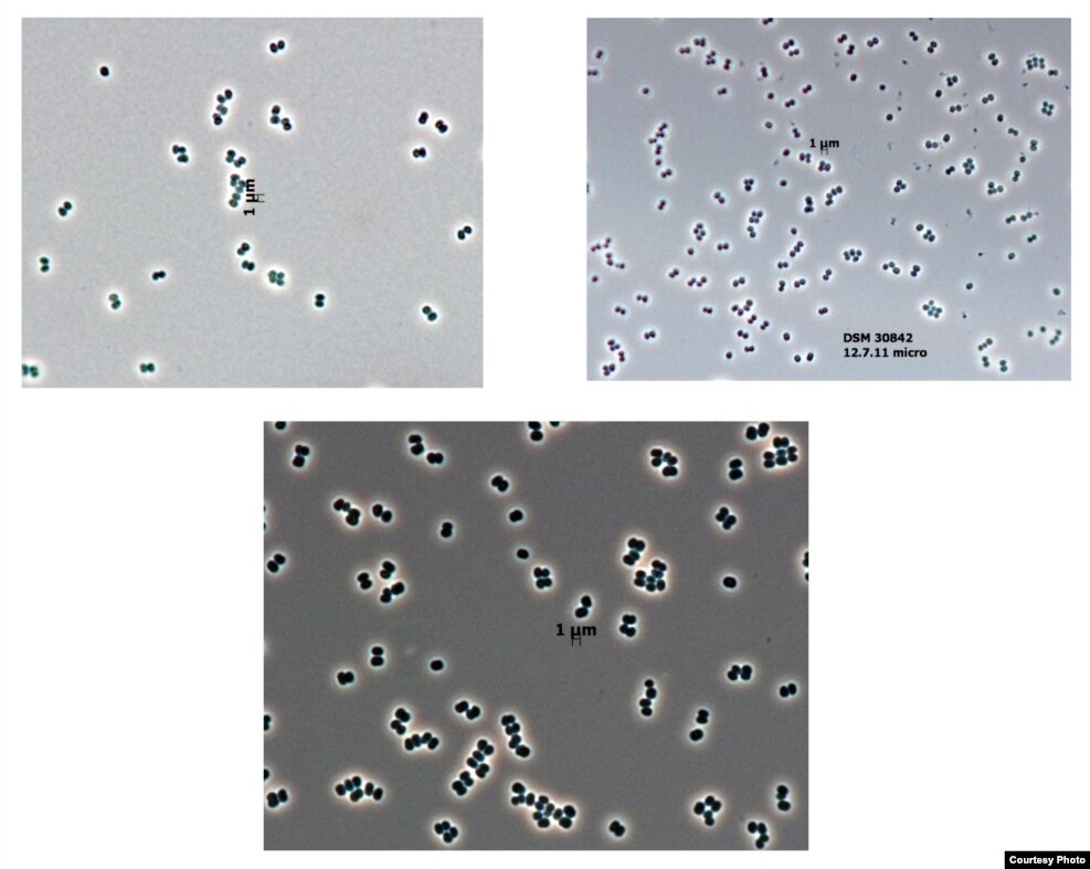 FoClean Room Microbes – ‘จุลินทรีย์ห้องสะอาด’ อาศัยอยู่ในห้องปลอดเชื้อขององค์การนาซ่าที่รัฐฟลอริด้า ซึ่งเป็นห้องที่สร้างขึ้นเพื่อป้องกันเชื้อโรคและจุลินทรีย์ต่างๆ ไม่ให้ติดไปกับยานอวกาศที่ไปลงจอดบนดาวดวงอื่น แต่นักวิทยาศาสตร์พบจุลินทรีย์ชนิดนี้ในห้องปลอดเชื้อดังกล่าว และยังพบด้วยว่าจุลินทรีย์นี้มีความทนทานต่อความแห้งแล้ง สภาพความเป็นกรด สภาพอากาศรุนแรง และรังสี UV ทำให้เกิดความกังวลว่าจุลินทรีย์ชนิดนี้อาจติดไปกับยานอวกาศที่ไปลงจอดดาวดวงอื่นได้ 