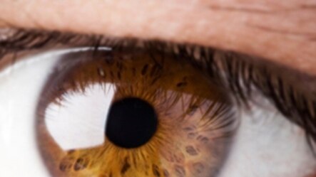 El ojo es uno de los órganos más afectados por la diabetes.