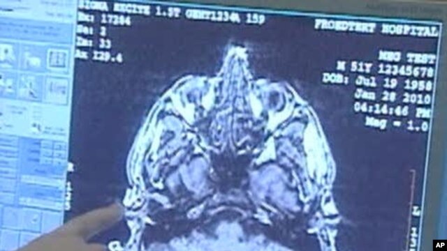 Study: Traumatic Brain Injury Patients at High Risk for Depression
