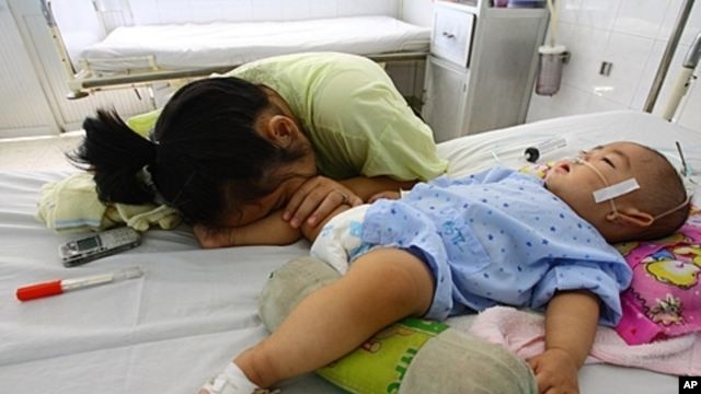 Một bé trai 9 tháng tuổi bị bệnh tay-chân-miệng được chữa trị tại một bệnh viên nhi đồng trong tỉnh Đồng Nai