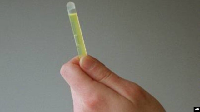Gynecologists are getting a new way to spot problems when they perform Pap smears to check women for cervical cancer. (file photo)