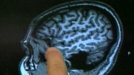 Skanerat MRI