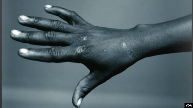 June 26 is International Day in Support of Torture (IRCT)