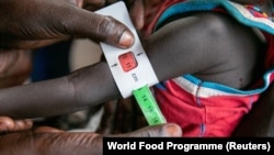 In this photo released by the World Food Programme (WFP) on Nov. 3, 2022, a woman is screened for malnutrition at a Nyong Primary Health Care Unit nutrition site in South Sudan where the WFP is offering supplementary feeding to children, pregnant and lactating women. 