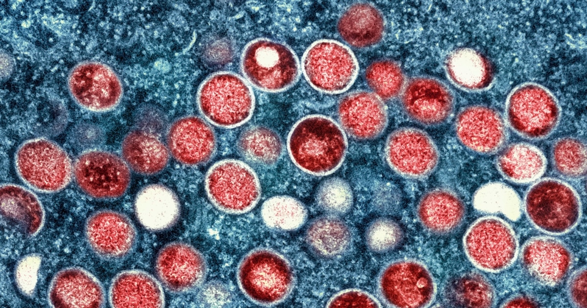 Africa not able to make vaccines with US funding cuts, say scientists