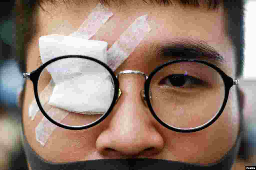 Un manifestante contra el proyecto de ley de extradición lleva un parche en el ojo, en señal de apoyo a un manifestante que resultó herido en los enfrentamientos del 11 de agosto con la policía, durante una protesta dentro de la terminal del aeropuerto en Hong Kong, China.