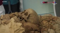 Միլանի հիվանդանոցը կիրառում է CT (համակարգչային տամոգրաֆիա) ՝ հայտնաբերելու եգիպտական մումիայի կյանքի և մահվանպայմանները