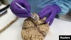 FILE - A researcher takes a tissue sample from a human brain at the Multiple Sclerosis and Parkinson’s UK Tissue Bank, at Imperial College London, Britain June 3, 2016. An appendix, often considered useless, seems to store an abnormal protein, which if it makes its way into the brain, has been found to become a hallmark of Parkinson's.