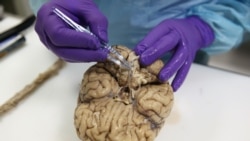 Quiz - Study Finds Some Brains Age Quicker Than Others