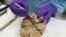 FILE - A researcher takes a tissue sample from a human brain at the Multiple Sclerosis and Parkinson’s UK Tissue Bank, at Imperial College London, Britain June 3, 2016. An appendix, often considered useless, seems to store an abnormal protein, which if it makes its way into the brain, has been found to become a hallmark of Parkinson's.