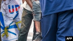 Un homme est blessé à la jambe lors d'une manifestation où des manifestants et des policiers se sont affrontés à Kinshasa le 9 juillet 2020 lors de manifestations organisées contre l'UDPS), pour la nomination du nouveau président de la Commission électorale. (AFP/Arsene Mpiana)