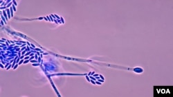 Causante de múltiples afecciones tanto en ojos, uñas, piel, órganos del aparato digestivo, huesos y en áreas de aplicación de catéteres en pacientes dentro de hospitales. El Centro Nacional de Microbiología Instituto de Salud Carlos III, en Madrid, España, considera que la “diseminación está condicionada por el estado inmunológico del huésped, aunque también se han barajado otros factores de virulencia, como la producción de toxinas y enzimas”; han descubierto que se adhiere al plástico de tubos hospitalarios y lentes de contacto. (Ilustración cortesía CDC)