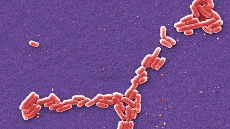 Bacterial Infections 'Second Leading Cause of Death Worldwide'