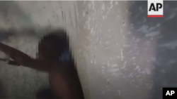 FILE - Screenshot of an AP video depicts a Child Refugee tortured in Libya, Sep 7, 2022. Video could not be verified. 