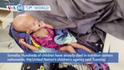 VOA60 World - U.N. reports hundreds of children have already died at nutrition centers in Somalia