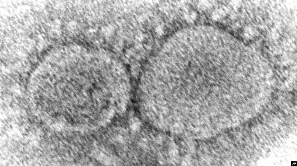 This 2020 electron microscope image made available by the Centers for Disease Control and Prevention shows SARS-CoV-2 virus particles which cause COVID-19.(Hannah A. Bullock, Azaibi Tamin/CDC via AP, File)