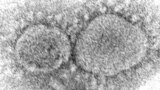 This 2020 electron microscope image made available by the Centers for Disease Control and Prevention shows SARS-CoV-2 virus particles which cause COVID-19.(Hannah A. Bullock, Azaibi Tamin/CDC via AP, File)