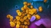 资料照片：美国国立卫生研究院2020年2月提供的这张未注明日期的彩色电子显微镜图像显示了在实验室培养的新型冠状病毒（黄色）从细胞表面（蓝色/粉红色）冒出。（美联社照片）