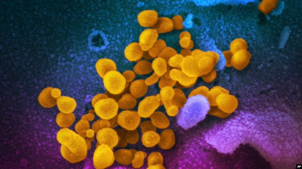 资料照片：美国国立卫生研究院2020年2月提供的这张未注明日期的彩色电子显微镜图像显示了在实验室培养的新型冠状病毒（黄色）从细胞表面（蓝色/粉红色）冒出。（美联社照片）(photo:VOA)