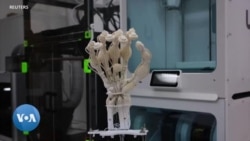 La première main imprimée en 3D avec des os et des tendons 