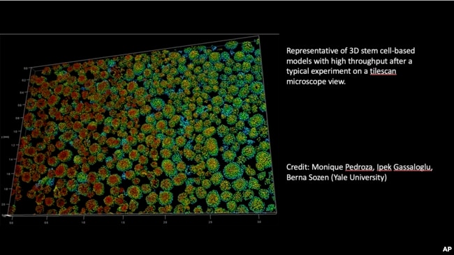 This graphic provided by Yale University shows an image of a human embryo model. (Monique Pedroza, Ipek Gassaloglu, Berna Sozen/Yale University via AP)