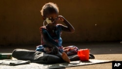 FILE - Two-year-old Akon Morro, who suffers from edema due to malnutrition, sits at a feeding center in Juba, South Sudan, Dec. 3, 2020. Health workers and officials from 15 sub-Saharan countries are meeting in Cameroon to discuss chronic child malnutrition in the region.