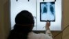 (FILE) A doctor checks the chest X-ray of a patient diagnosed with tuberculosis at the Médecins Sans Frontières clinic in Mumbai.