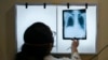 FILE - In this picture taken on March 22, 2022, a doctor checks the chest X-ray of a patient diagnosed with tuberculosis at the Médecins Sans Frontières clinic in Mumbai.