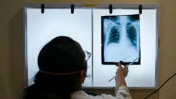 TB Alliance: Stronger Commitments Needed to End TB