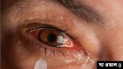 সারা ভারতে বাড়ছে চোখের সংক্রমণ, বর্ষায় প্রকোপ বাড়াচ্ছে কনজাংটিভাইটিস 