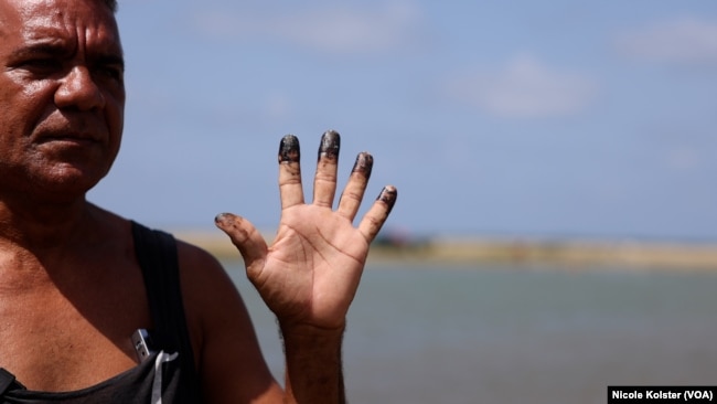 Willy Villegas muestra sus manos teñidas de negro luego de alzar una red de pesca dañada producto de un derrame de hidrocarburos. Falcón, Venezuela