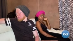 Os desafios das pessoas com albinismo em Malanje