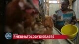 Health Report: Rheumatic Diseases on the Rise in Africa