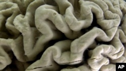 Ljudski mozak (Foto: AP Photo/David Duprey)