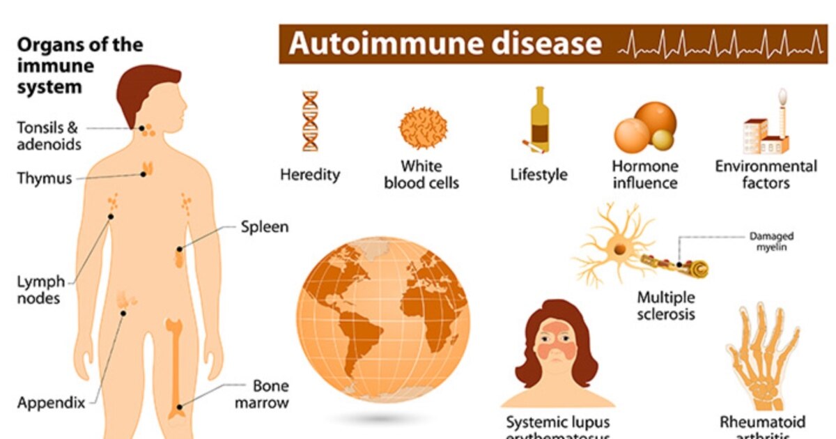 Autoimmune Diseases Affect More Women than Men