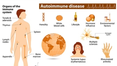 Autoimmune Diseases Affect More Women than Men