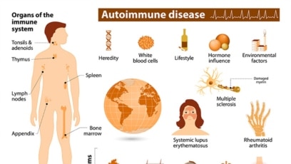 Quiz - Autoimmune Diseases Affect More Women than Men