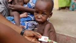 Au Tchad, une malnutrition qui persiste à Kanem