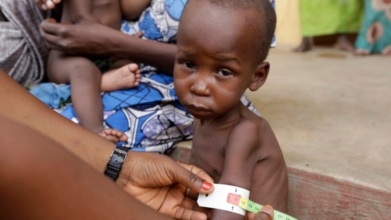 Au Tchad, une malnutrition qui persiste à Kanem